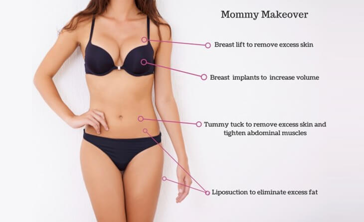 Annelik Estetiği (Mommy Makeover)