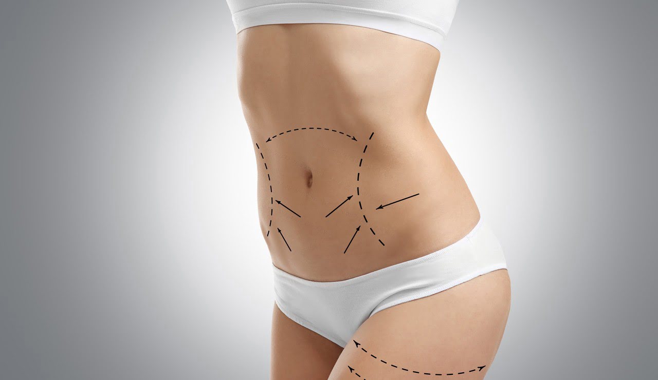 Karın Liposuction